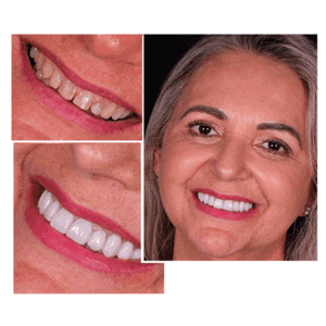 Facetas-1-768x768